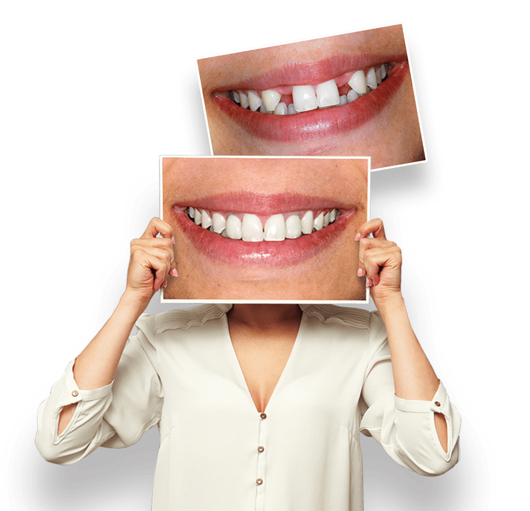estética dental alcala