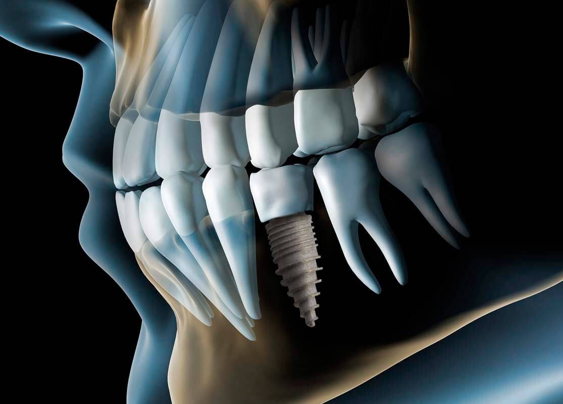 Cirujano Maxilofacial en Alcalá de Henares: excelencia médica y confianza en Clínica Fronteras