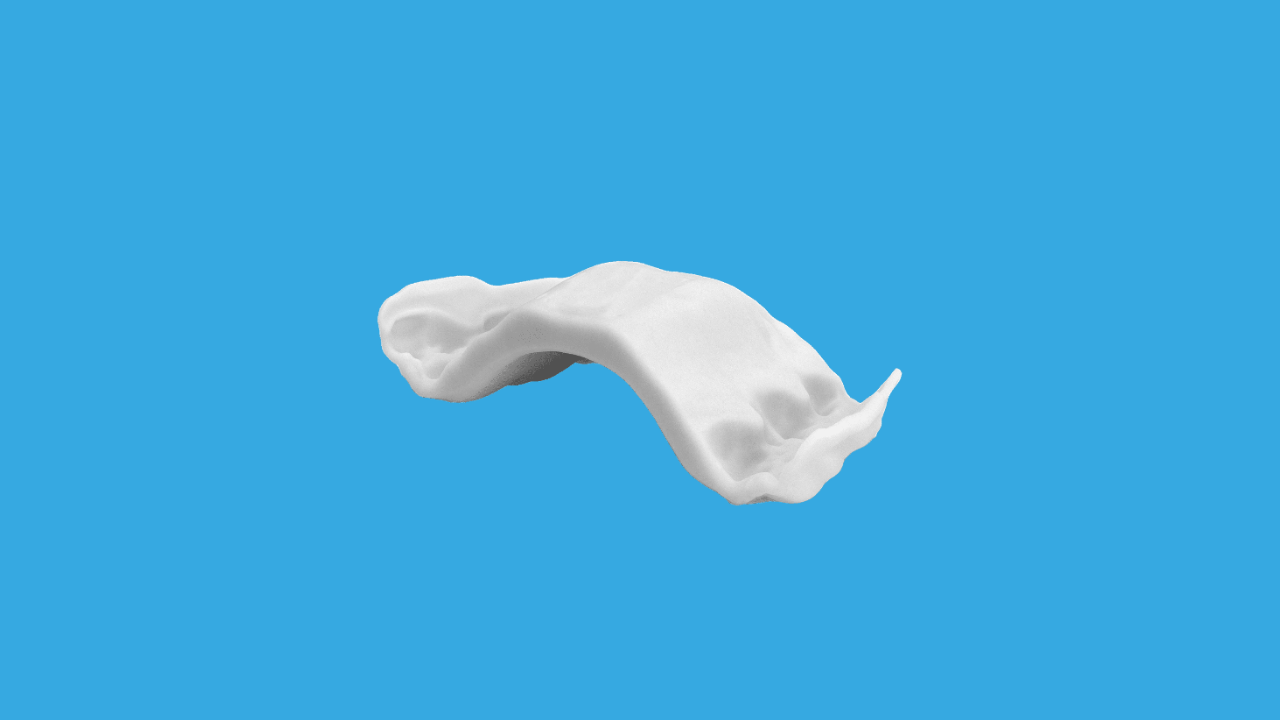Invisalign Palatal Expander: qué es, cuándo se recomienda y cómo mejora el desarrollo de la sonrisa